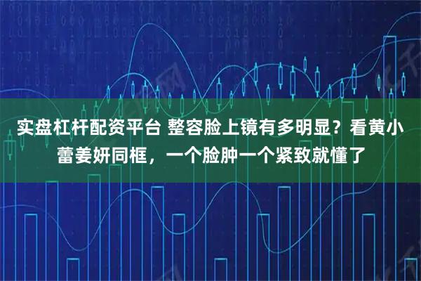 实盘杠杆配资平台 整容脸上镜有多明显？看黄小蕾姜妍同框，一个脸肿一个紧致就懂了